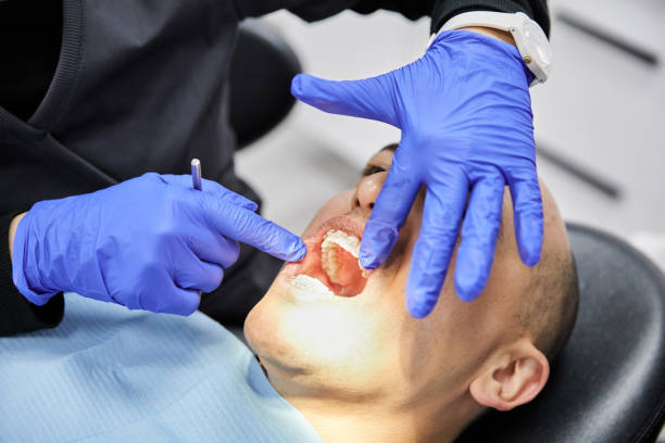 Best Broken or Chipped Tooth Repair in Kiel, WI